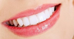 Perguntas e Respostas sobre Aparelho Dentário: Tudo o que você precisa saber!