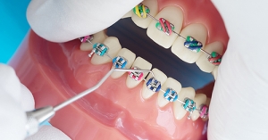 Saiba Mais Sobre Ortodontia e Funções