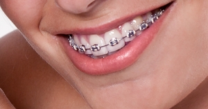 Entendendo a Ortodontia: Transformando Seu Sorriso