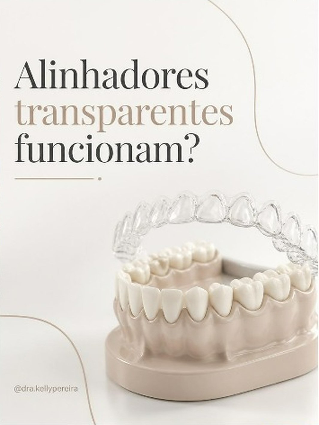 Alinhadores transparentes funcionam? - Dra. Kelly Pereira, ortodontista em Ribeirão Preto