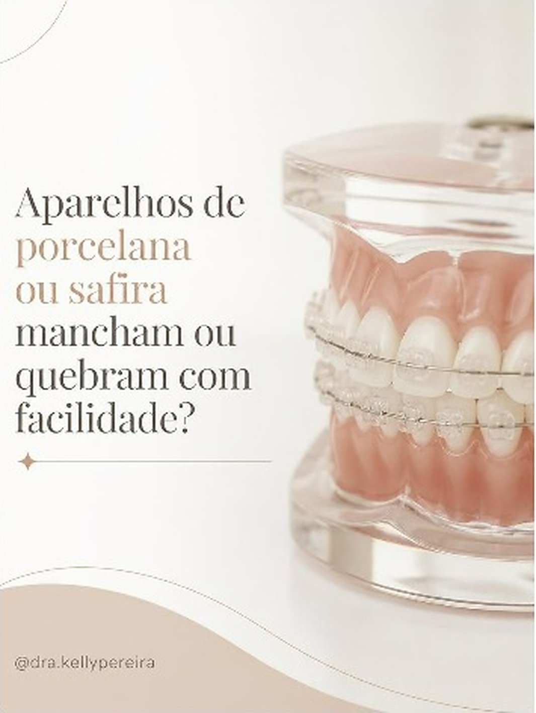 Aparelhos de porcelana ou safira mancham ou quebram com facilidade? - Dra. Kelly Pereira, ortodontista em Ribeirão Preto