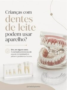 Crianças com dentes de leite podem usar aparelho? - Dra. Kelly Pereira, ortodontista em Ribeirão Preto