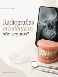 Radiografias ortodônticas são seguras? - Dra. Kelly Pereira, ortodontista em Ribeirão Preto
